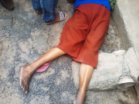 Ao ser atropelada, a senhora fraturou o fêmur