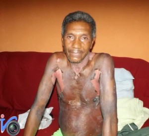 (Foto: Itambé Verdade)