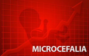 Microcefalia